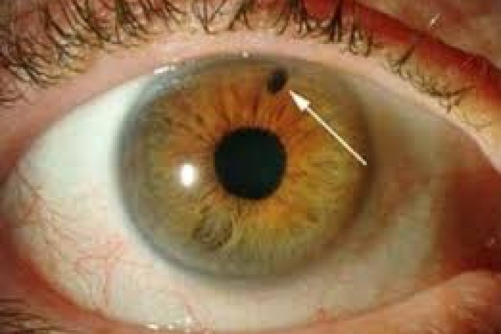 images (1) images (1)